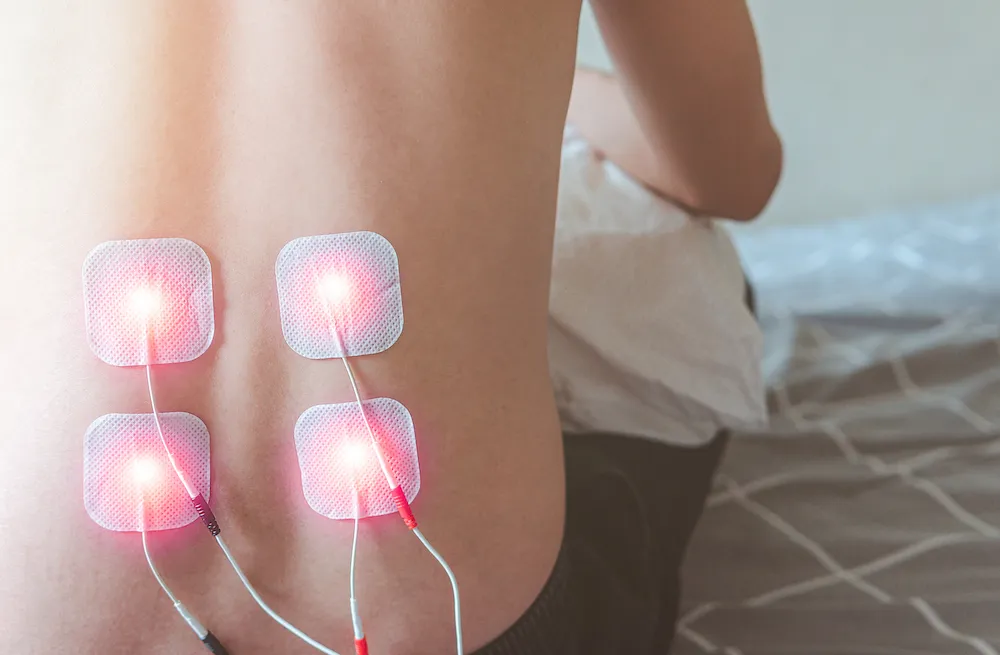 Four glowing e-stim electrode pads placed on a patient's lower back