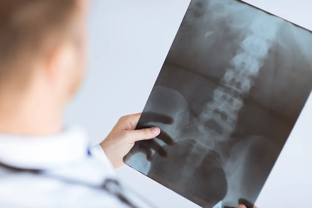 Doctor holding up an X-ray film of the lower spine