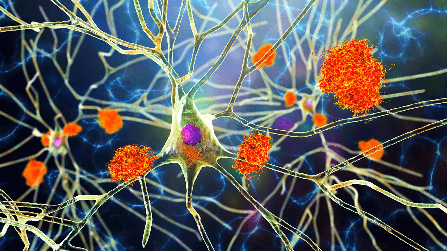 Illustration of nerve cells with glowing orange clusters