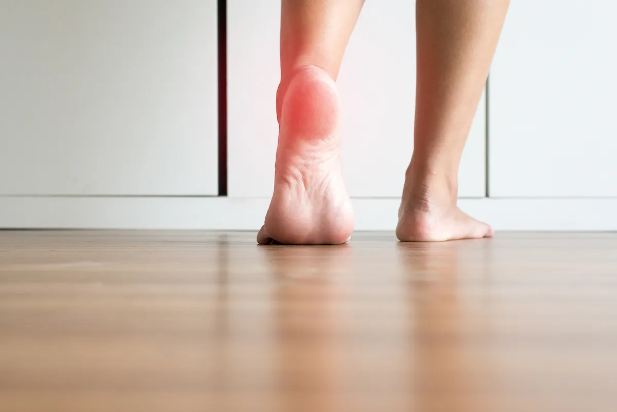 plantar fasciitis pain location