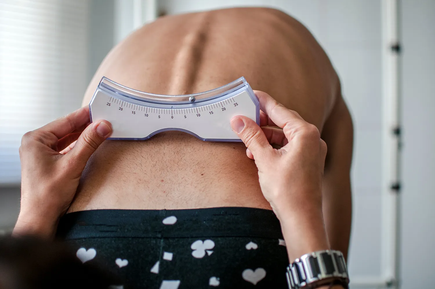 Clinician measuring spinal curvature with a scoliometer on a patient's back
